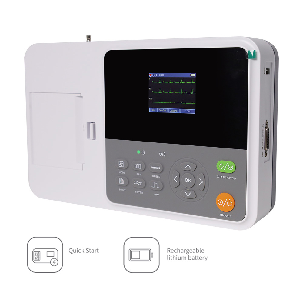Mesin EKG Digital Portabel CON - Ekg Ecg Machine Portable ulasan dan harga